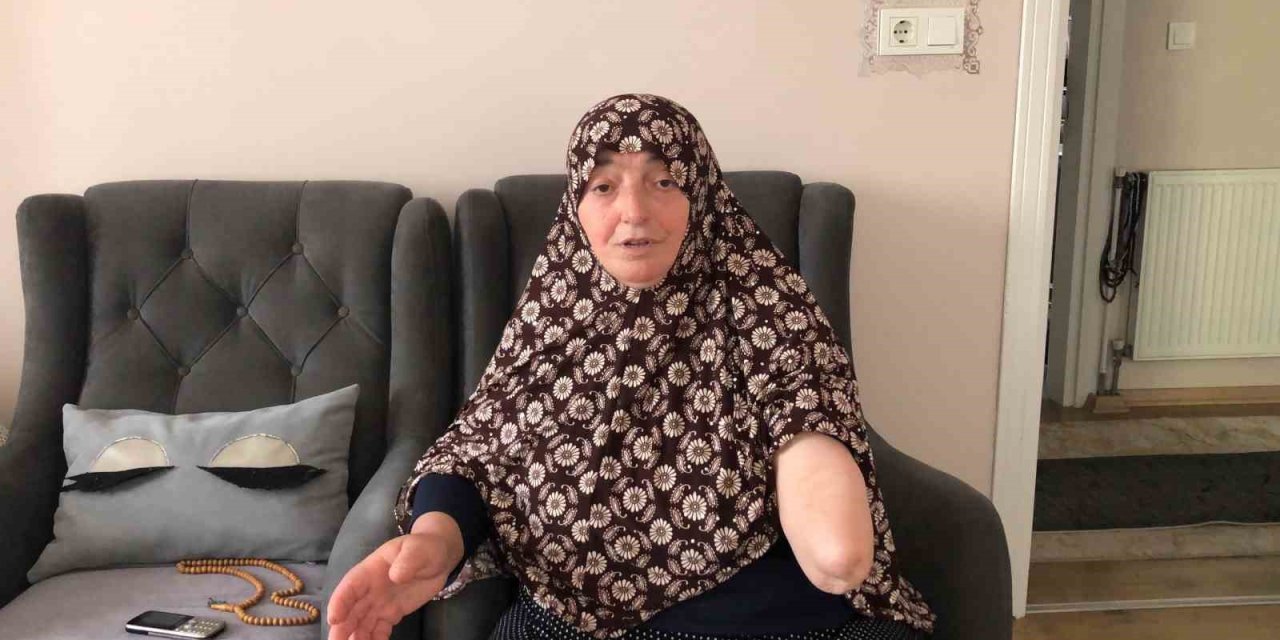 Köpekler kolunu parçaladı, gözleri açık gitti