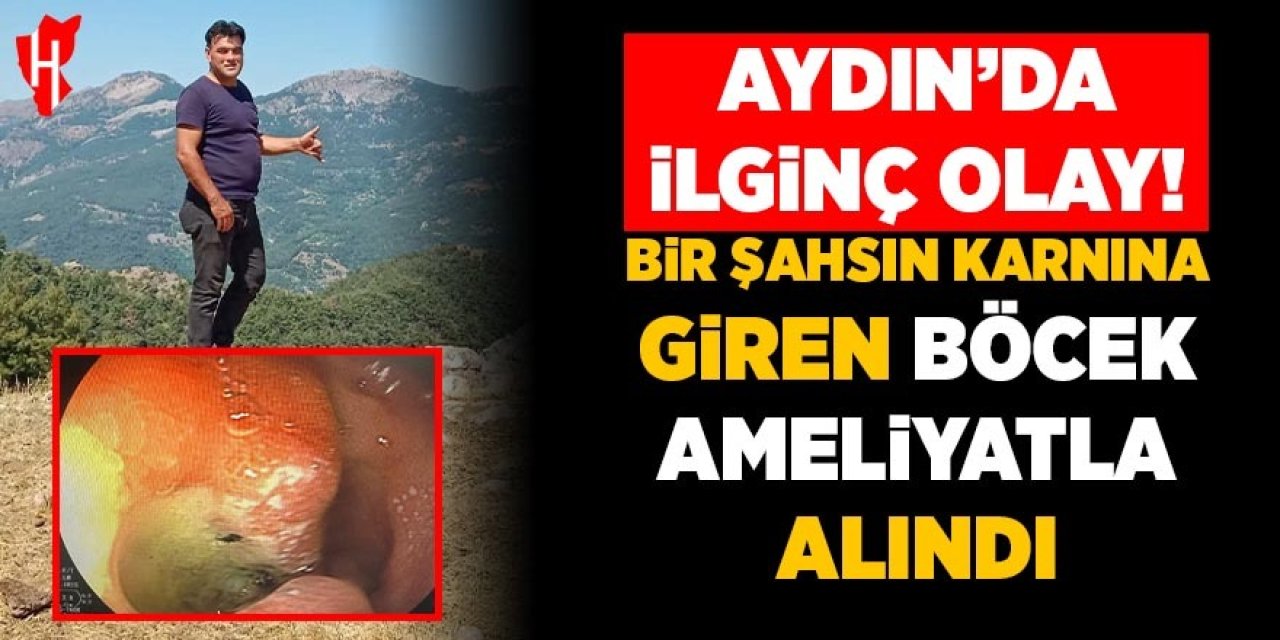 Aydın'da ilginç olay! Bir şahsın karnına giren böcek ameliya