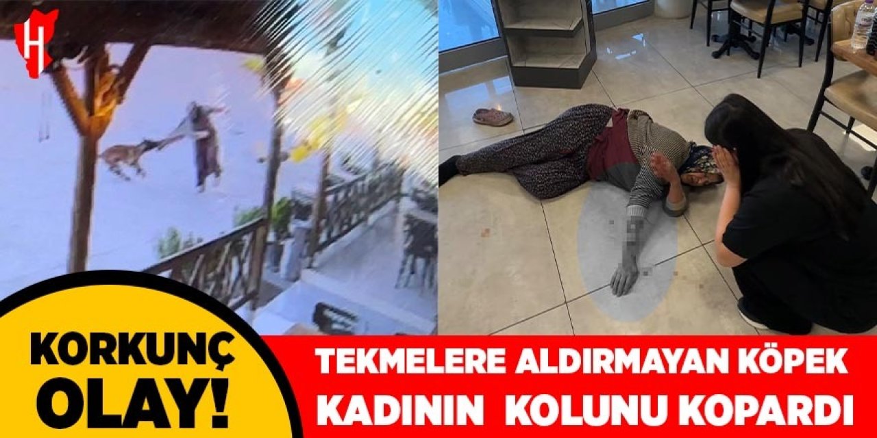 Tekmelere aldırmayan köpek kadının kolunu kopardı