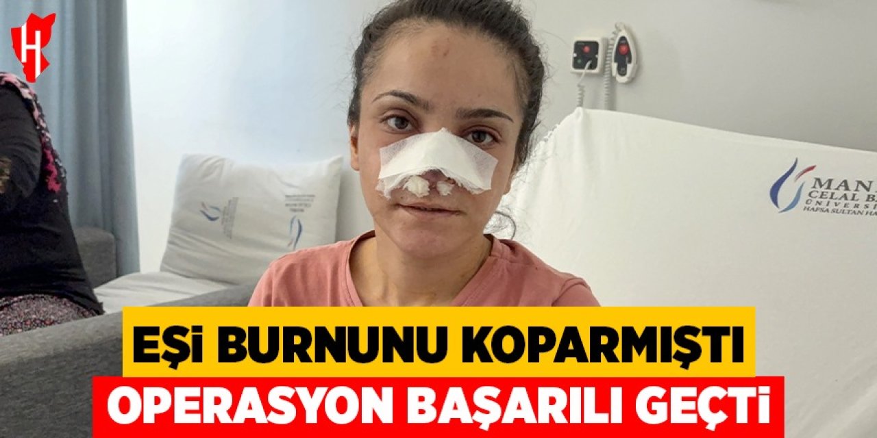 Eşi burnunu koparmıştı: Operasyon başarılı geçti
