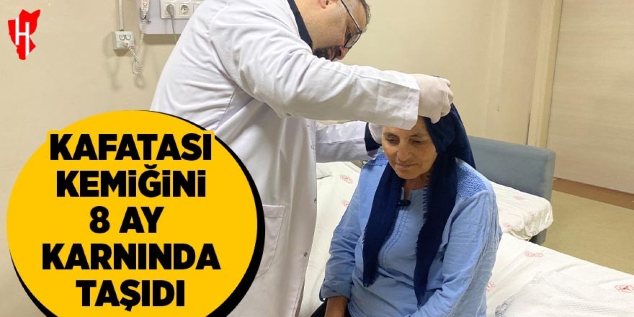 Kafatası kemiğini 8 ay karnında taşıdı