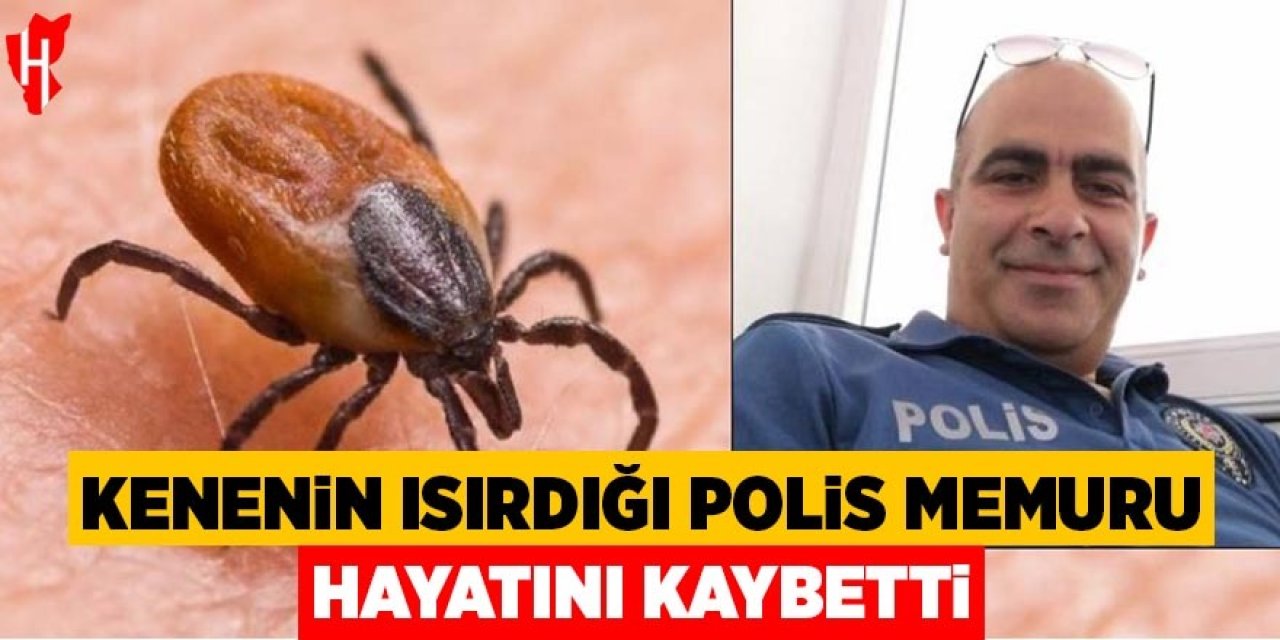 Kenenin ısırdığı polis memuru hayatını kaybetti