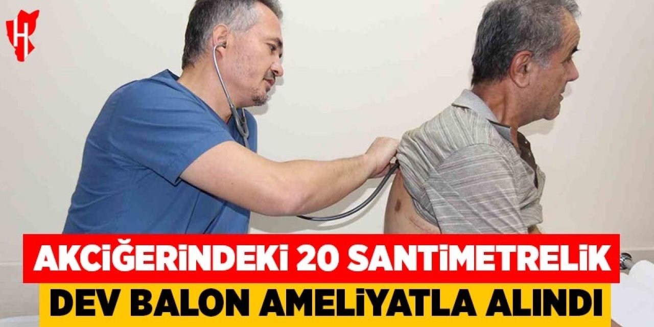 Akciğerindeki 20 santimetrelik dev balon ameliyatla alındı