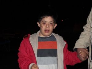 Down Sendromlu Çocuk Okuldan Eve Darp Edilmiş Halde Döndü