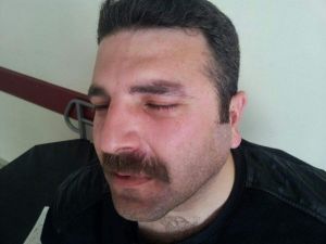 Sağlık Memurunu Darp Ettiler