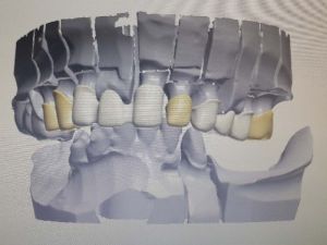 Diş Tedavisinde Bilgisayar Teknolojisi