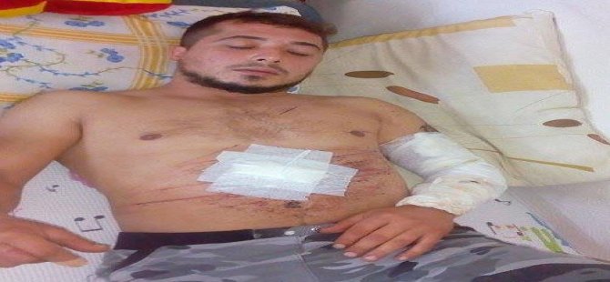 Önce ateş açtı;sonra cam parçalarıyla kendini kesti