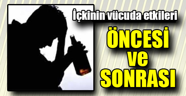 İçkiyi Bıraktıktan Sonra Vücuda Olan Etkileri