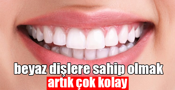 Bembeyaz Dişlere Sahip Olmak Artık Çok Kolay