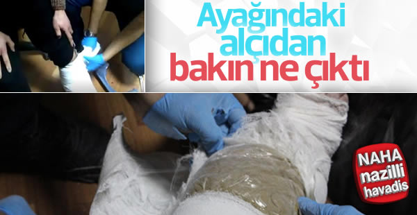 Ayağındaki alçıdan bakın ne çıktı