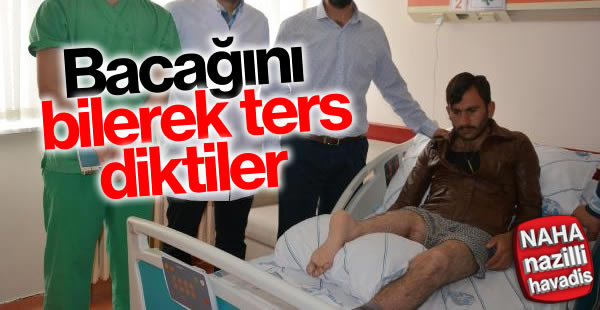 Bacağını bilerek ters diktiler