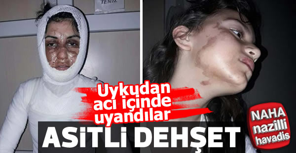 Uyuyan hala ve yeğenine asitli saldırı