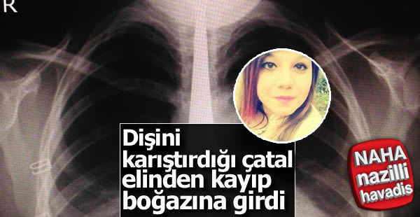 Çürük dişini karıştırdığı çatal boğazına kaçtı